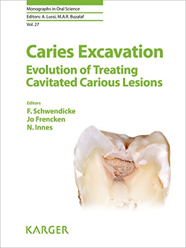 Caries Excavation Evolution of Treating Cavitated Carious Lesions (Monographs in Oral Science, Vol. 27)